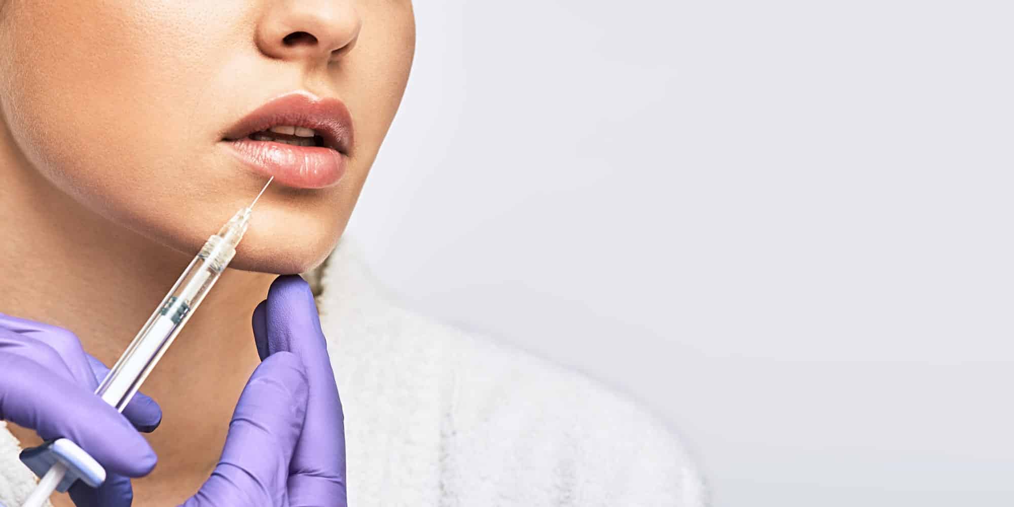 Dermal Fillers