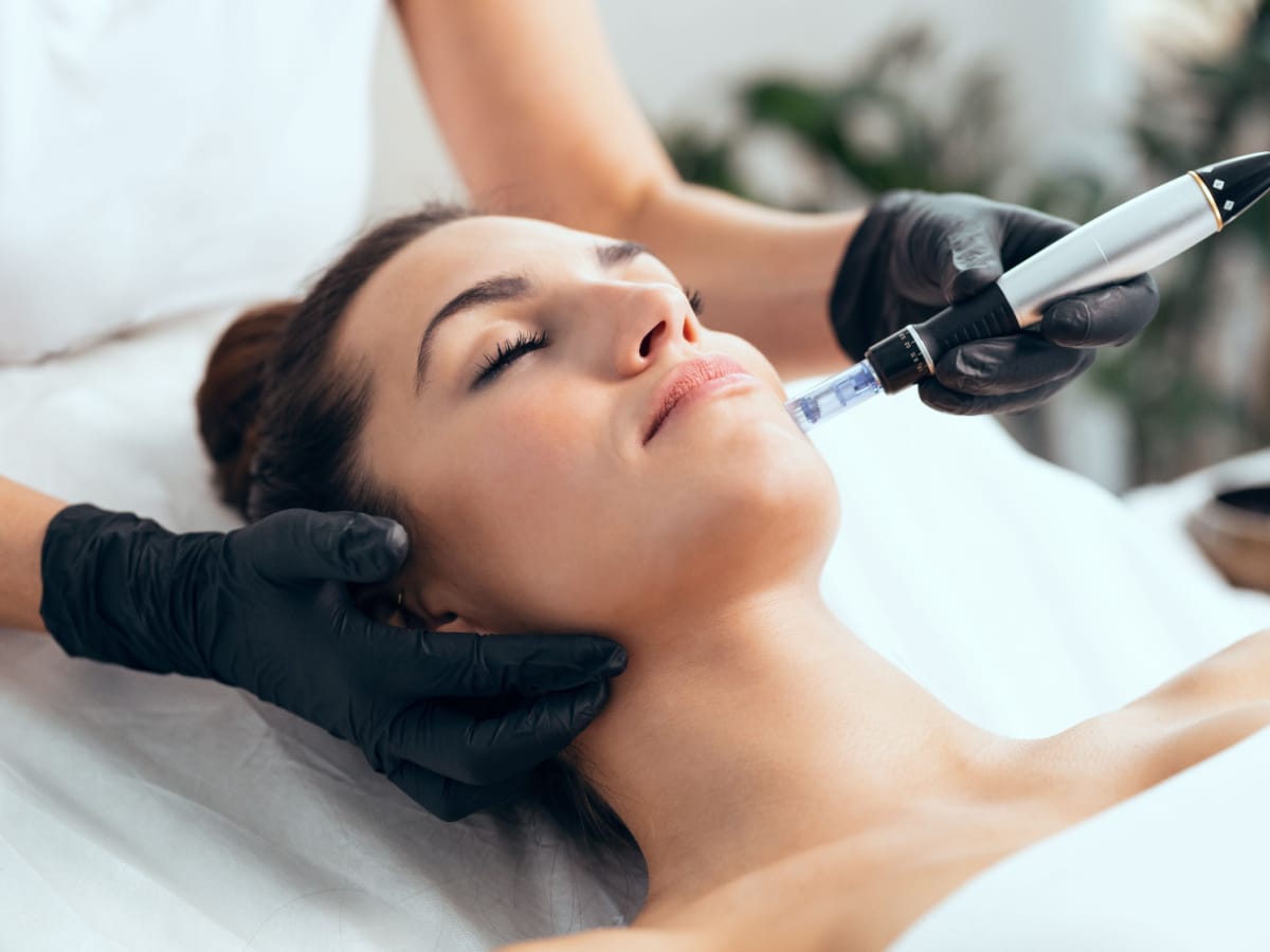 Microneedling Treatment